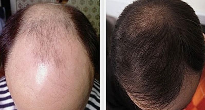 Before & After